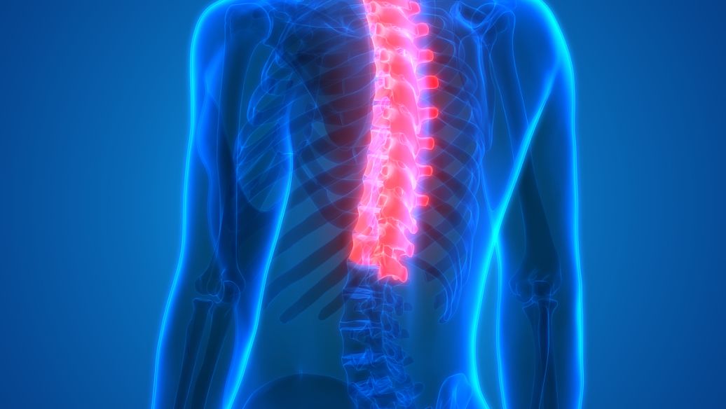 脊柱脊髓损伤并发深静脉血栓的预防与诊治